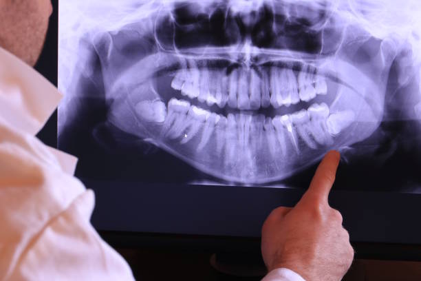 Best Emergency Dental Care for Broken or Chipped Teeth in South Point, OH