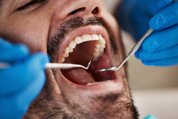 Best Pediatric Emergency Dentist in South Point, OH
